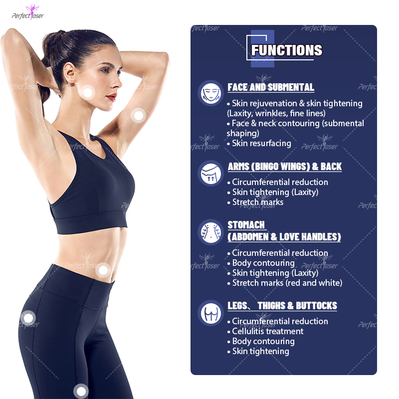 퍼펙트레이저 4 in 1 벨라 바디 스컬프트 쉐이프 슬 - Vacuum Cavitation Body Contouring 리뷰 및 가격