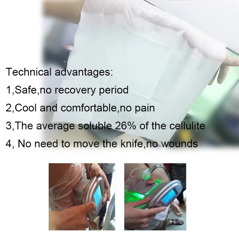 지방 동결용 항냉각 멤브레인 크라이오리폴리시스 기계 슬 - Cryolipolysis Fat Freezing Machine 리뷰 및 가격