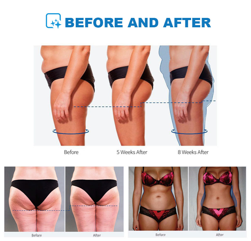 전자기 4핸들 EMSLIM 네오 바디 슬리밍 EMS 쉐 - Ems Body Sculpting Machine Emslim 리뷰 및 가격