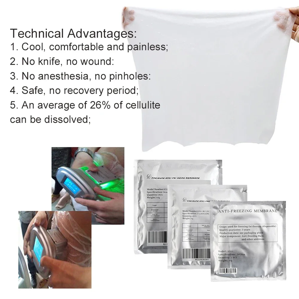 동결 방지 멤브레인 슬리밍 패치 지방 동결 크라이오리폴 - Cryolipolysis Fat Freezing Machine 리뷰 및 가격