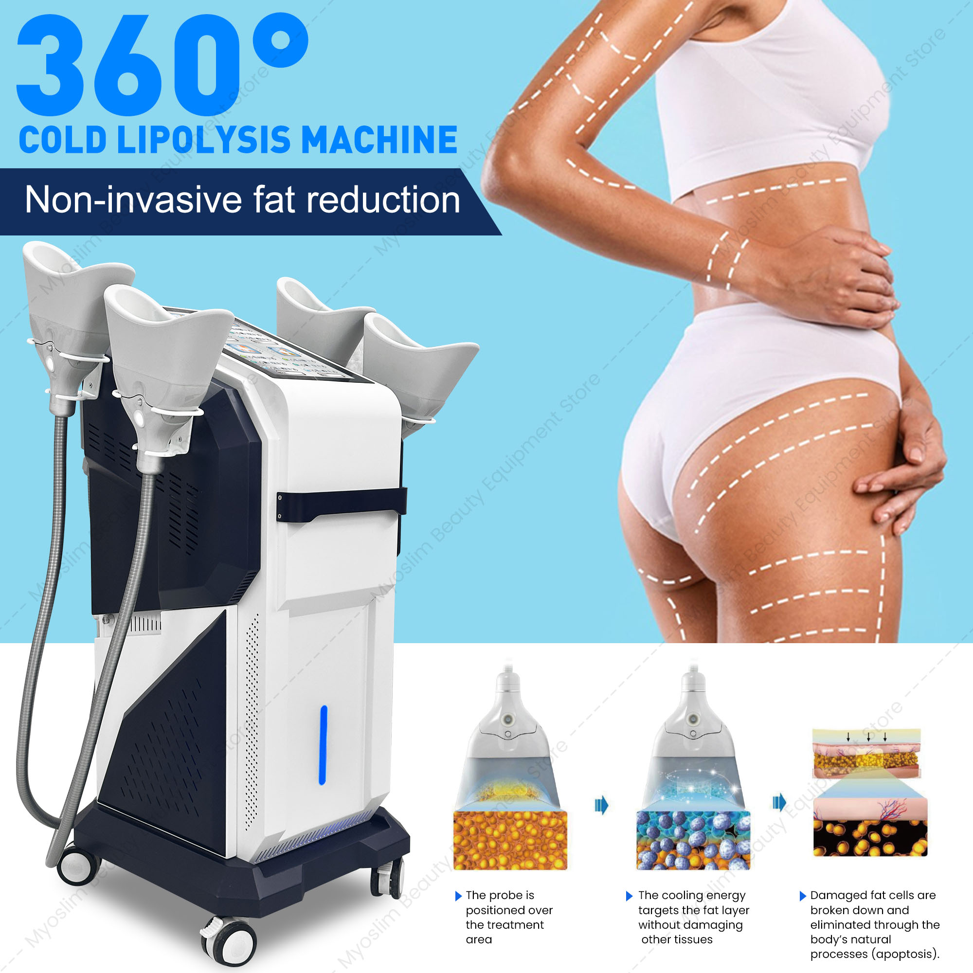 360 °   4채널 냉동지방분해 기계 – 15.6인치 - Cryolipolysis Fat Freezing Machine 리뷰 및 가격