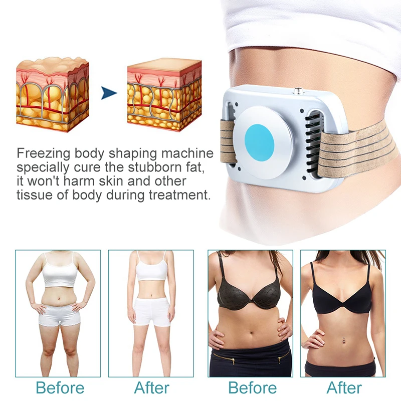 새로운 크라이오리폴리시스 기계 지방 동결 복부 지방 연 - Cryolipolysis Fat Freezing Machine 리뷰 및 가격