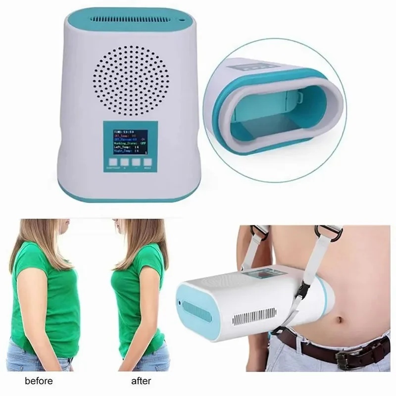 2026 미니 크라이오리폴리시스 기기, 고성능 바디 슬 - Cryolipolysis Fat Freezing Machine 리뷰 및 가격