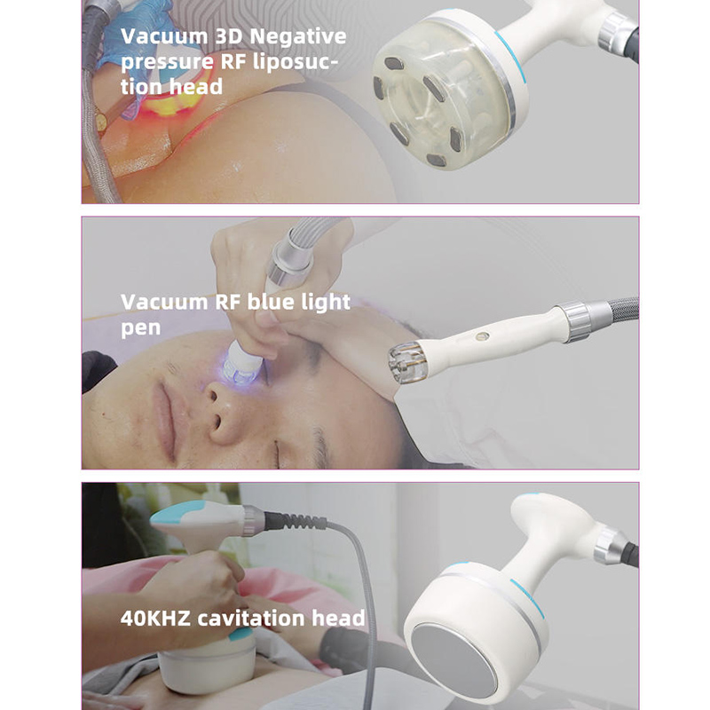 새로운 전문가용 V-TEM 바디 컨투어링 셀룰라이트 제 - Vacuum Cavitation Body Contouring 리뷰 및 가격